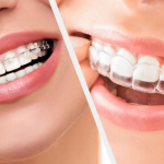 Orthodontiste
